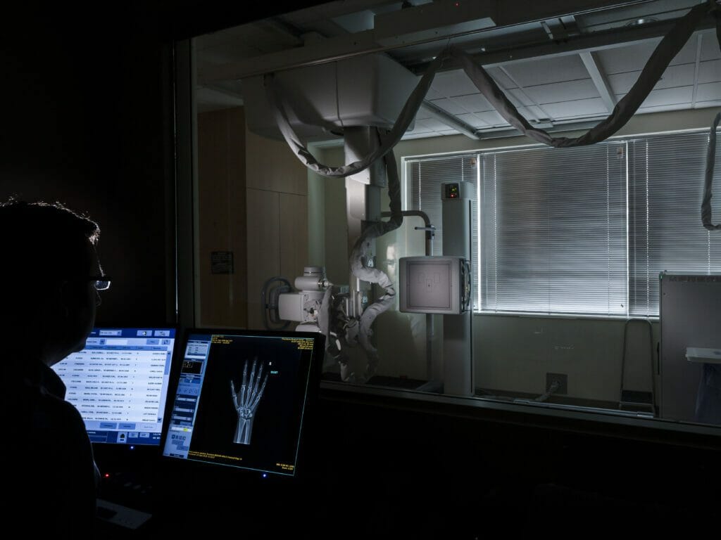 A man looking at an X-ray of a hand